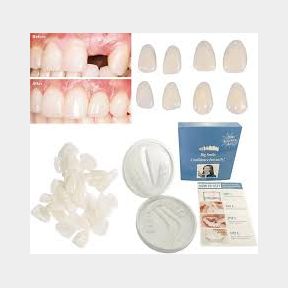 Beautiful Smiles Veneers - D.I.Y Broken missing and teeth Whitening kit Bar 9901077089848-51748/8485