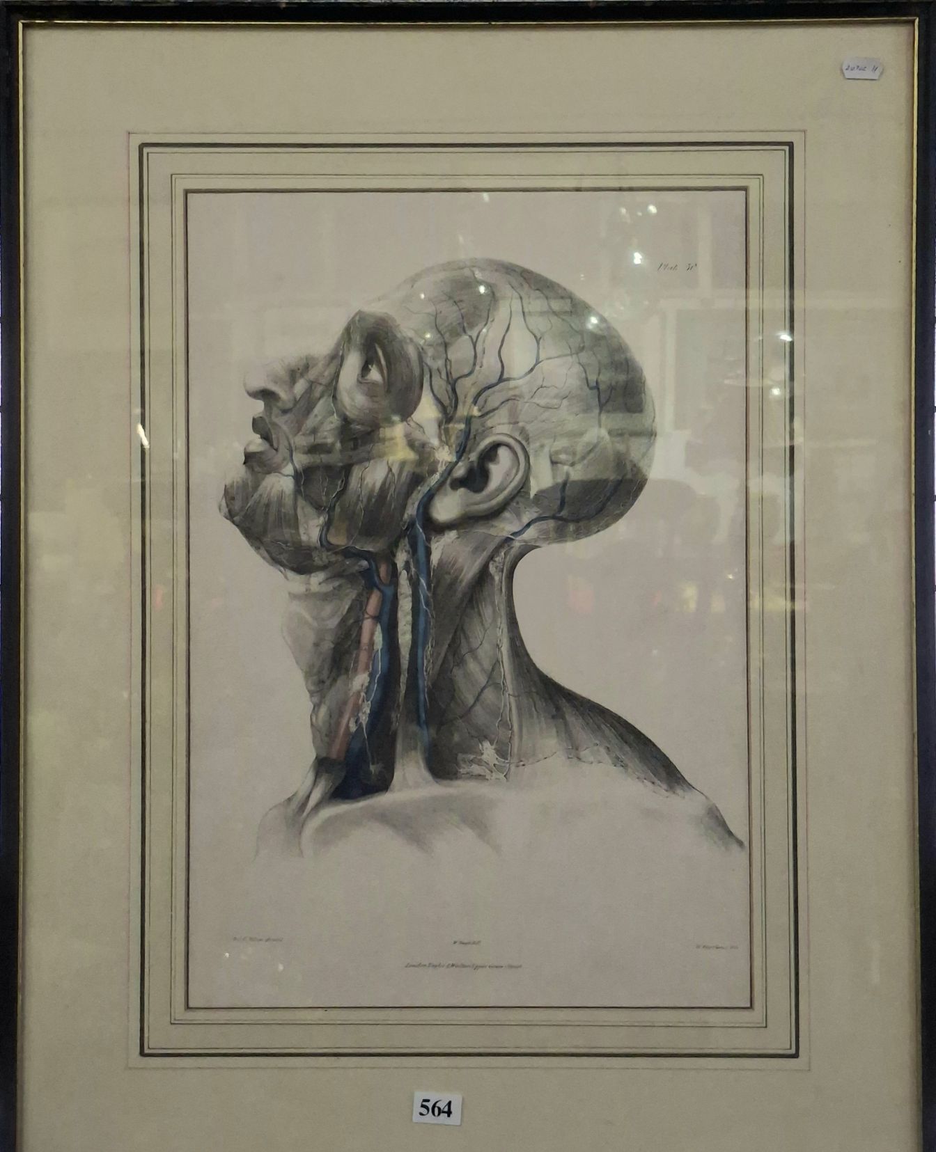 Anatomical Lithograph